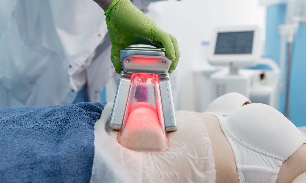 Aparelho de criolipólise